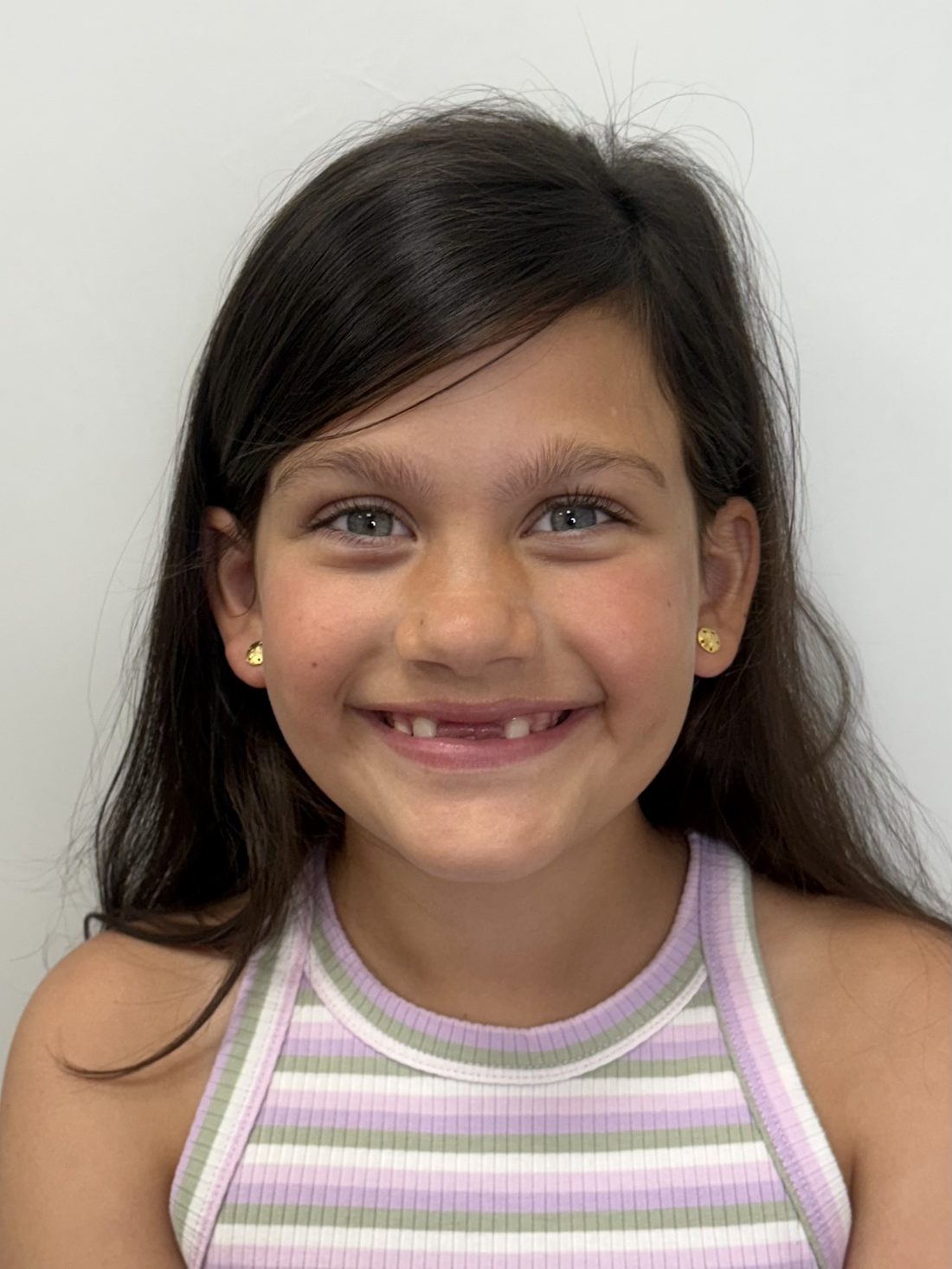 Young patient smiling at NA Orthodontics in North Arlington, NJ
